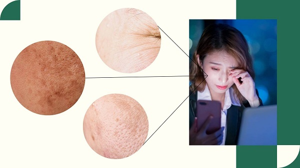 Tác động của ánh sáng xanh từ màn hình đến làn da